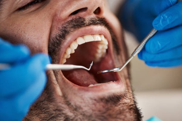 Best Emergency TMJ Treatment in Morgantown, IN
