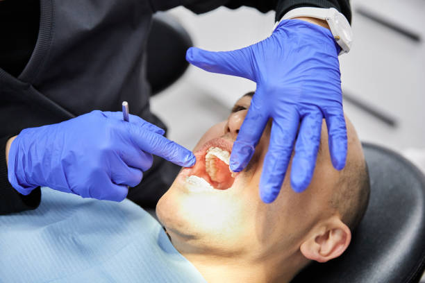 Best Emergency Root Canal Treatment in Morgantown, IN